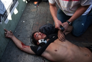 Student v Caracasu zraněný obrojenými složkami.