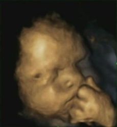 Jedno ze sledovaných dětí, které se dotýkalo úst levou rukou. Snímek pochází ze 32. týdne těhotenství.