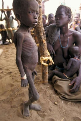 Nakrmte nás... Etiopie. Stále se opakujicí hladomory.
