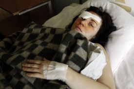 Jekatěrina Marišinová byla zraněna při útoku na moskevské metro.