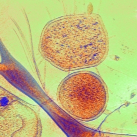 Mikroskopický snimek organismu ARMAN (oranžová koule).