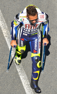 Rossi stále chodí o berlích.