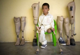Afghánský chlapec s protézami.
