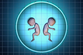 Dvojčata jsou náročná pro matky i zdravotnictví.