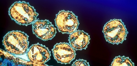 Nově vytvořené viry HIV unikají z infikované buňky.