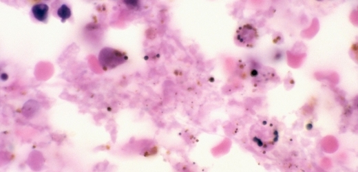 Mor má pod mikroskopem růžovou barvu, přesto je zván černou smrtí.