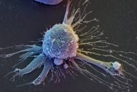 Lidská embryonální kmenová buňka - naděje moderní medicíny.