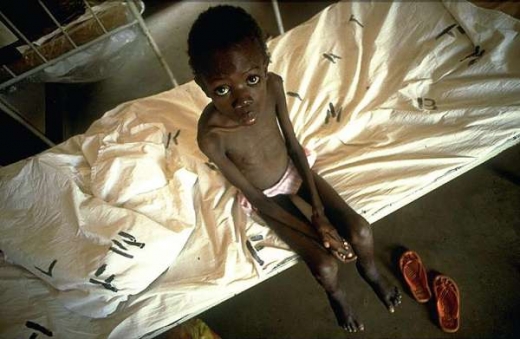Dítě nemocné AIDS v Tanzanii.