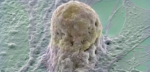Lidská embryonální buňka - naděje moderní medicíny.