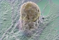 Lidská embryonální buňka - naděje moderní medicíny.