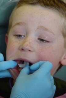 Pro rodiče není v současné době vůbec jednoduché sehnat pro dítě zubaře (ilustrační foto).