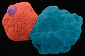 Pro kmenové buňky se využívají embrya ve stadiu shluku stovek buněk.