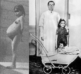 Lina Medina, nejmladší matka na světě. Před porodem a s porodníkem a synem Gerardem v kočárku.