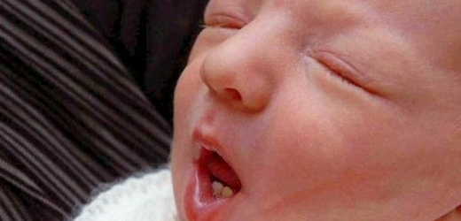 Malý Oliver James se narodil se dvěma zuby.
