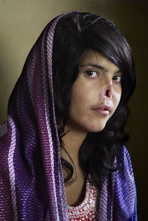 Nejvyšší ocenění v prestižní soutěži World Press Photo získal šokující portrét afghánské ženy, které její manžel uřízl nos a uši. Autorkou snímku je fotografka Jodi Bieberová.