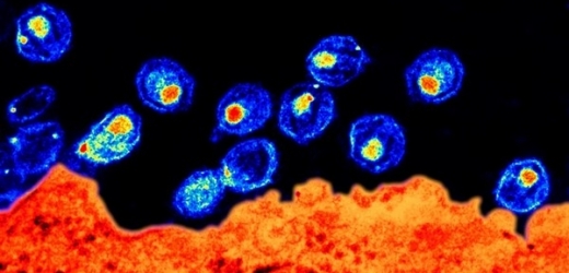 Většinu virů bylo dosud možno spatřit pouze v elektronovém mikroskopu (na snímku).