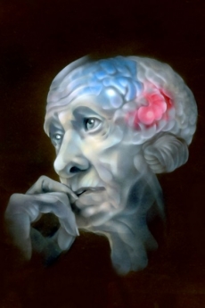 Hipokampus (červeně) patří k částem mozku, které postihuje Alzheimerova choroba.