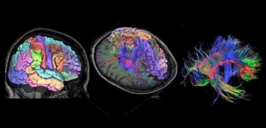 Atlas nabízí detailní snímky anatomie mozku a informace o aktivitě jednotlivých genů.