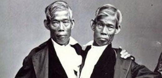 Nejznámější dvojčata v historii - Eng a Chang Bunkerové.