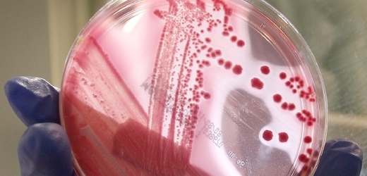 Střevní bakterie EHEC.