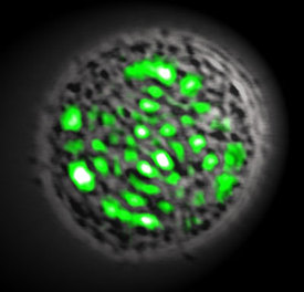 Lidská buňka s genem z medúzy zeleně září, světlo se koncentruje do laserového paprsku.