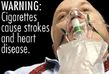 Kouření způsobuje kardiovaskulární problémy, varují odborníci.