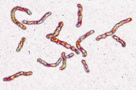 Bakterie TBC.