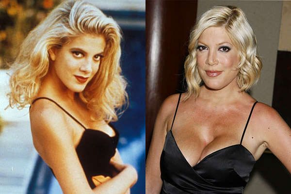 Pamatujete si Donnu z kultovního seriálu Beverly Hills 90210 z devadesátých let? Hrála ji dnes osmatřicetiletá Tori Spellingová - a předtím, než si nechala neumětelsky zvětšit prsa, to byla půvabná americká dívka.