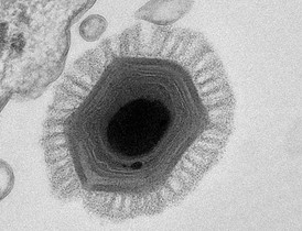 Megavirus objevený v měňavkách u chilského pobřeží.