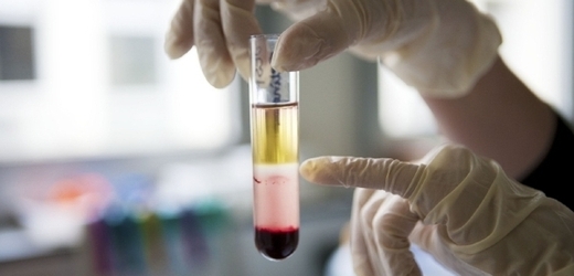 Kmenové buňky hrají zejména při léčbě leukemie a dalších onemocněních krve zásadní roli.
