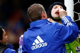 Petr Čech si o víkendu v anglické lize zlomil nos.