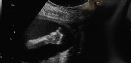 Jsi jednička, vzkázalo miminko na tomto ultrazvuku své mamince.