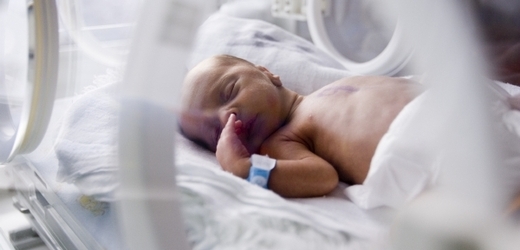 Předčasně narozené děti tráví v inkubátorech i několik měsíců.