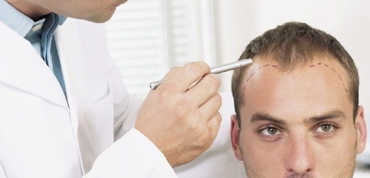 Chřipka může u některých lidí spouštět problémy s vlasovými kořínky.