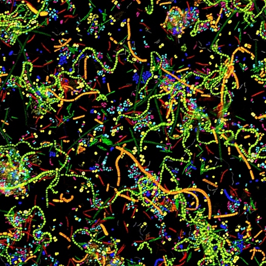 Nová zobrazovací metoda umí na jednom snímku rozlišit až 28 bakteriálních druhů.