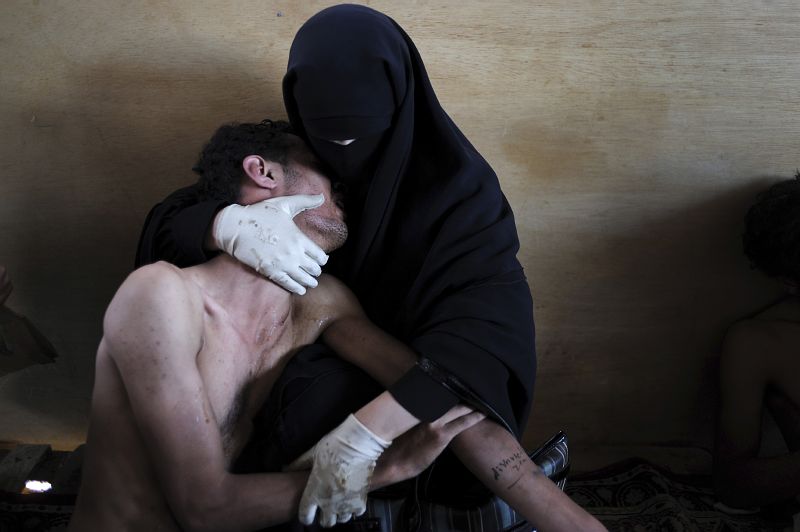 Žena drží v náručí svého zraněného příbuzného během protestů proti prezidentovi v hlavním městě Jemenu Saná, 15. říjen 2011. Fotografie roku, Samuel Aranda, Španělsko.