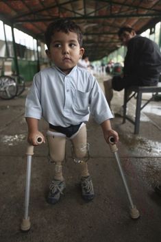 Oběť násilí v Afghánistánu. Chlapec s protézami místo nohou.