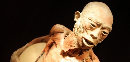 Exponáty vystavované v Praze vznikly z lidských těl.