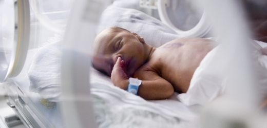 Většina úmrtí předčasně narozených dětí je zbytečná, tvrdí lékaři. Jejich život může zachránit inkubátor a antibiotika. 