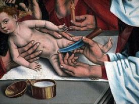 Malíř Friedrich Herlin: Obřezání Ježíše (1488).