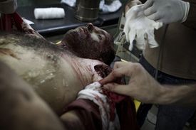 Rebel zasažený palbou z helikoptéry umírá na operačním stole v Alepu.