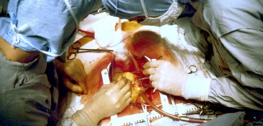 Řada nemocnic se možná snažila vydělávat hlavně na operacích srdce (ilustrační foto).