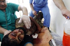 Povstalec zraněný kulkou odstřelovače v Homsu.