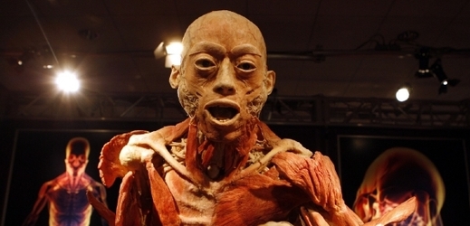 Lidské exponáty vznikají jedinečnou metodou plastinace, s níž přišel německý anatom Günther von Hagens.
