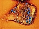 Bakterie Neisseria gonorrhoeae na povrchu děložního hrdla.
