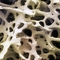 Houbovitá kostní tkáň pod mikroskopem.