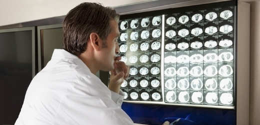V Česku vznikne síť center pro léčbu rakoviny plic (ilustrační foto).