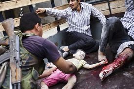 Těžce zraněný chlapec a další zraněný civilista v Alepu. 