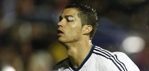 Cristiano Ronaldo vstřelil i se zraněním oka gól.