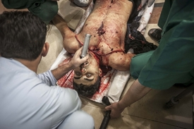 Bezvládné tělo syrského rebela zasaženého do čelisti vládním odstřělovačem.